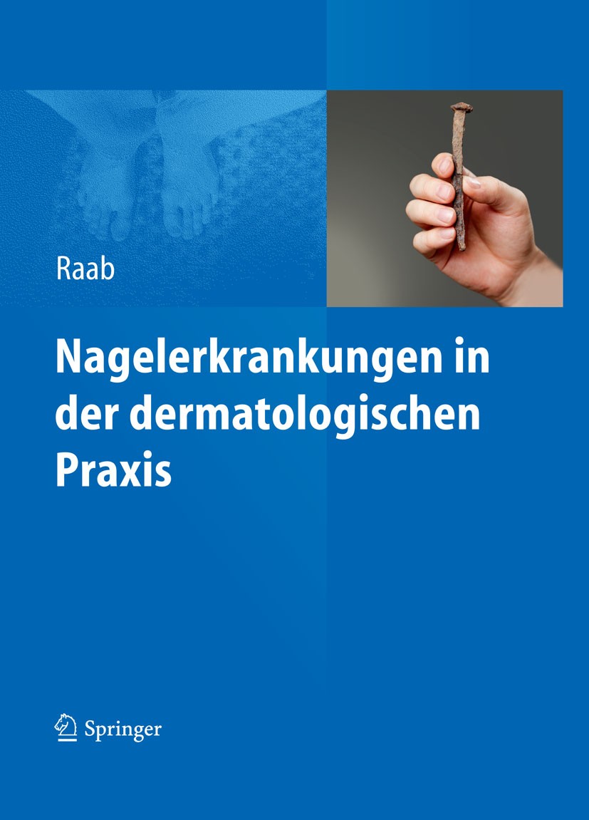 Titlebook: Nagelerkrankungen in der dermatologischen Praxis; Wolfgang Raab Book 2012 Springer-Verlag GmbH Berlin Heidelberg 2012 Fingernagel.Fußnagel Titlebook: Nagelerkrankungen in der dermatologischen Praxis; Wolfgang Raab Book 2012 Springer-Verlag GmbH Berlin Heidelberg 2012 Fingernagel.Fußnagel