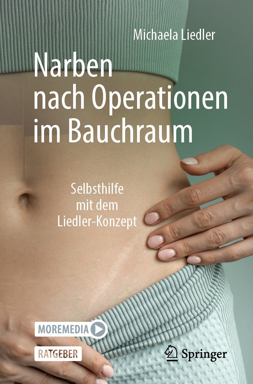 Titlebook: Narben nach Operationen im Bauchraum; Selbsthilfe mit dem Michaela Liedler Book 2024 Der/die Herausgeber bzw. der/die Autor(en), exklusiv Titlebook: Narben nach Operationen im Bauchraum; Selbsthilfe mit dem Michaela Liedler Book 2024 Der/die Herausgeber bzw. der/die Autor(en), exklusiv