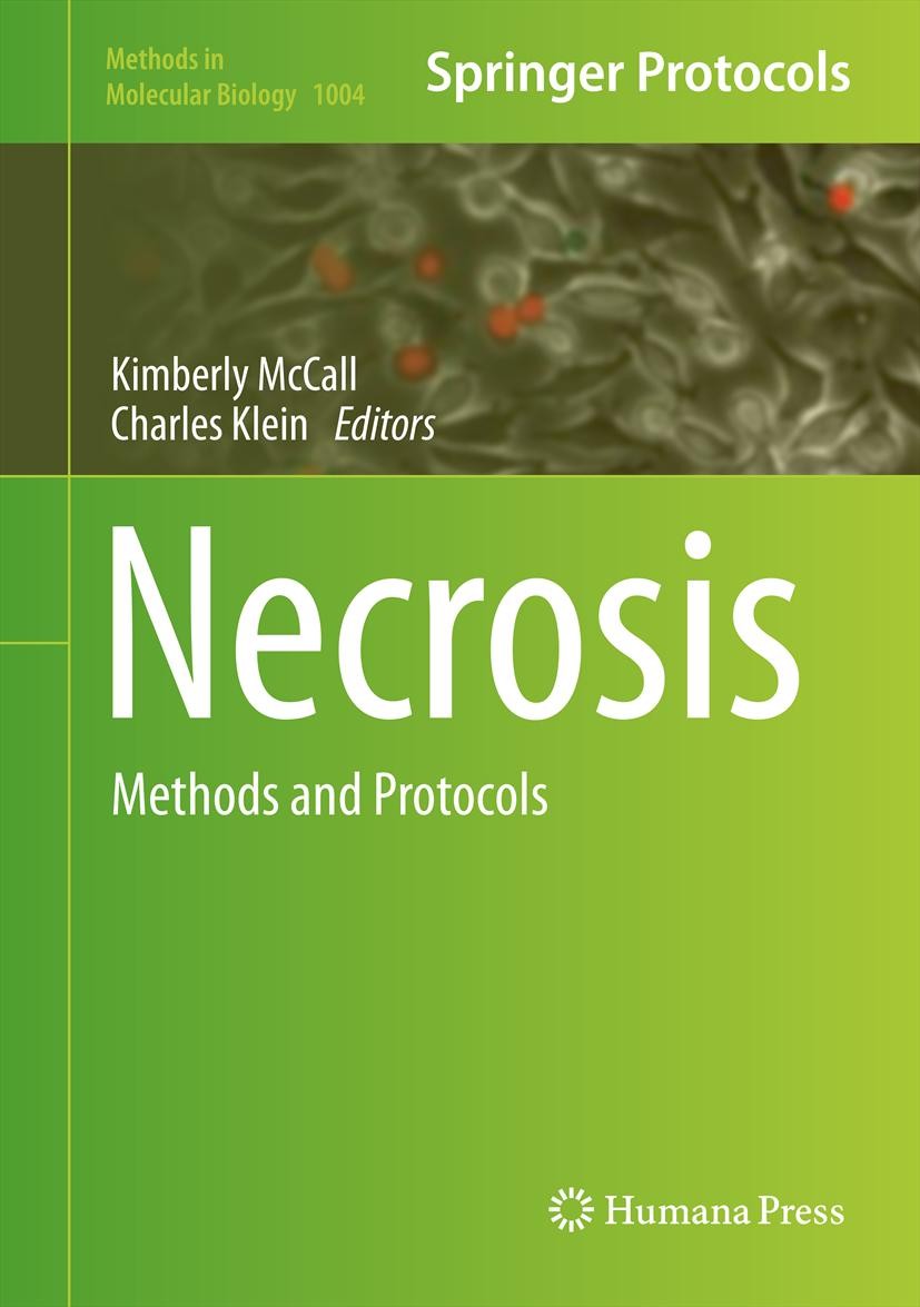 Titlebook: Necrosis; Methods and Protocol Kimberly McCall,Charles Klein Book 2013 Springer Science+Business Media, LLC 2013 Biochemical.apoptosis in v Titlebook: Necrosis; Methods and Protocol Kimberly McCall,Charles Klein Book 2013 Springer Science+Business Media, LLC 2013 Biochemical.apoptosis in v
