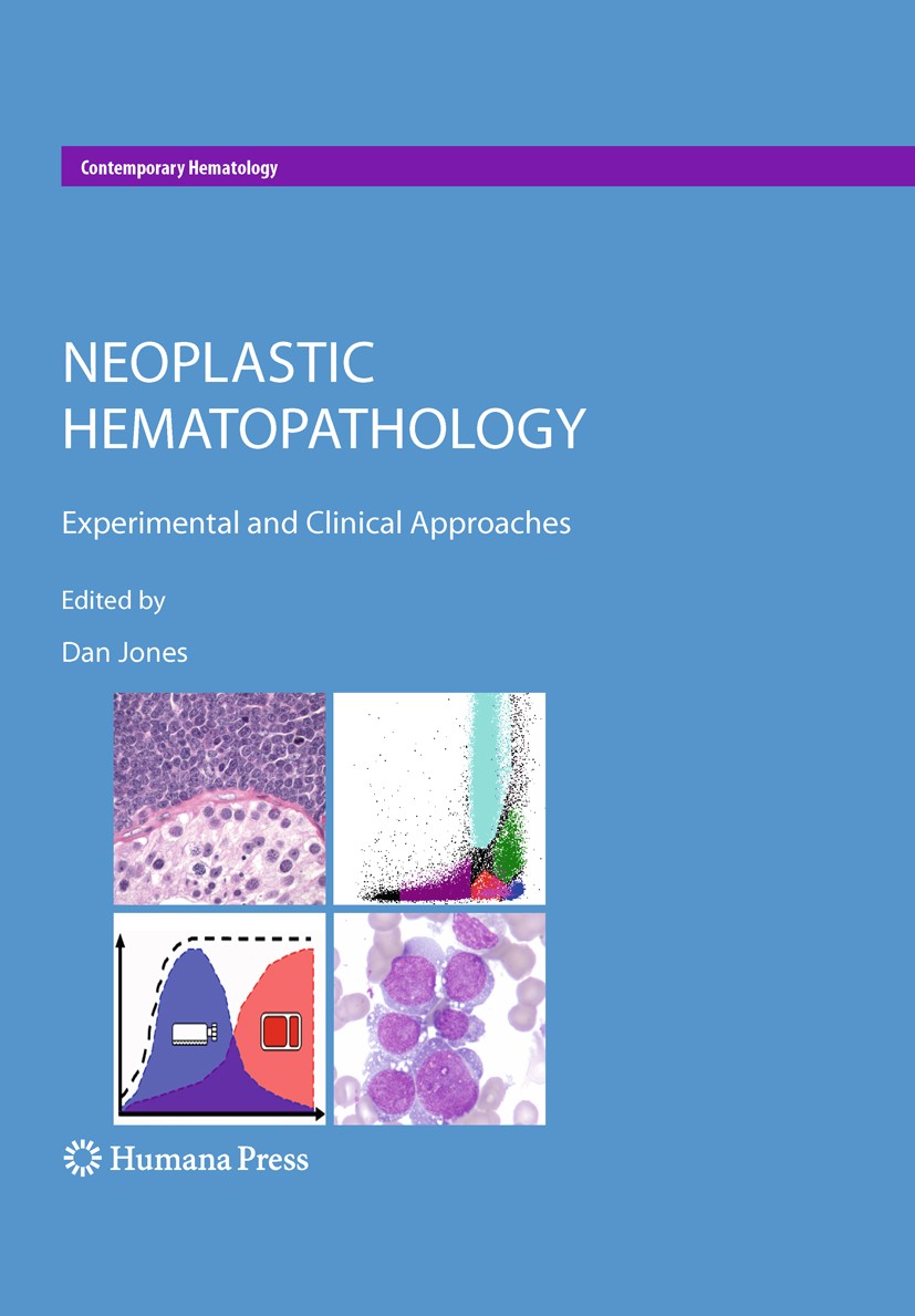 Titlebook: Neoplastic Hematopathology; Experimental and Cli Dan Jones Book 2010 Humana Press 2010 Blood.Cancer.Hematology.Hematopathology.Leukemia.Lym Titlebook: Neoplastic Hematopathology; Experimental and Cli Dan Jones Book 2010 Humana Press 2010 Blood.Cancer.Hematology.Hematopathology.Leukemia.Lym