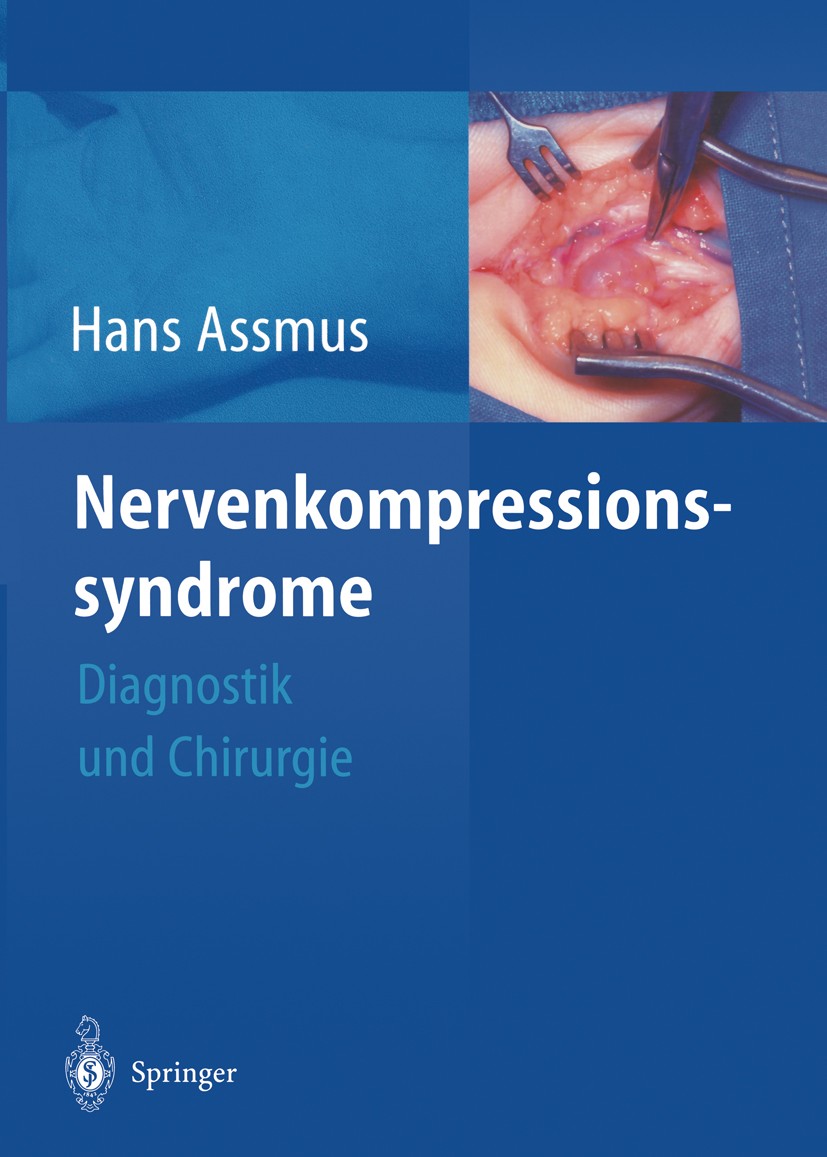Titlebook: Nerven-kompressions-syndrome; Diagnostik und Chiru Hans Assmus,Gregor Antoniadis Book 2003 Springer-Verlag Berlin Heidelberg 2003 Ambulante Titlebook: Nerven-kompressions-syndrome; Diagnostik und Chiru Hans Assmus,Gregor Antoniadis Book 2003 Springer-Verlag Berlin Heidelberg 2003 Ambulante