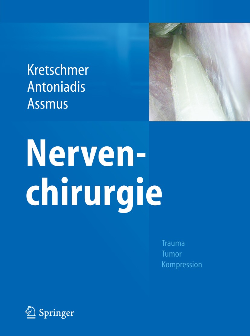 Titlebook: Nervenchirurgie; Trauma, Tumor, Kompr Thomas Kretschmer,Gregor Antoniadis,Hans Assmus Book 2014 Springer-Verlag Berlin Heidelberg 2014 Mikr Titlebook: Nervenchirurgie; Trauma, Tumor, Kompr Thomas Kretschmer,Gregor Antoniadis,Hans Assmus Book 2014 Springer-Verlag Berlin Heidelberg 2014 Mikr