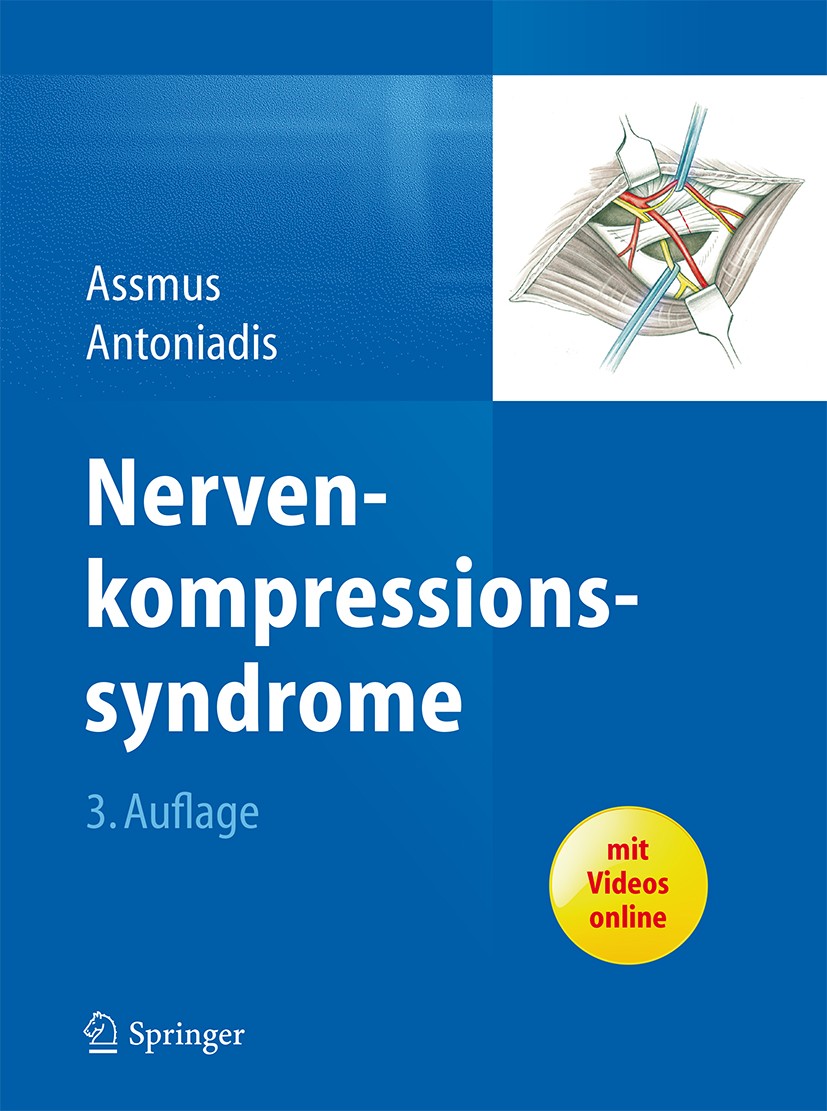 Titlebook: Nervenkompressionssyndrome; Hans Assmus,Gregor Antoniadis Book 20153rd edition Springer-Verlag Berlin Heidelberg 2015 Karpaltunnelsyndrom. Titlebook: Nervenkompressionssyndrome; Hans Assmus,Gregor Antoniadis Book 20153rd edition Springer-Verlag Berlin Heidelberg 2015 Karpaltunnelsyndrom.