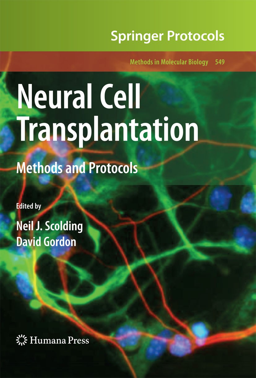 Titlebook: Neural Cell Transplantation; Methods and Protocol David Gordon,Neil J. Scolding Book 20091st edition Humana Press 2009 Embryonic stem cells Titlebook: Neural Cell Transplantation; Methods and Protocol David Gordon,Neil J. Scolding Book 20091st edition Humana Press 2009 Embryonic stem cells