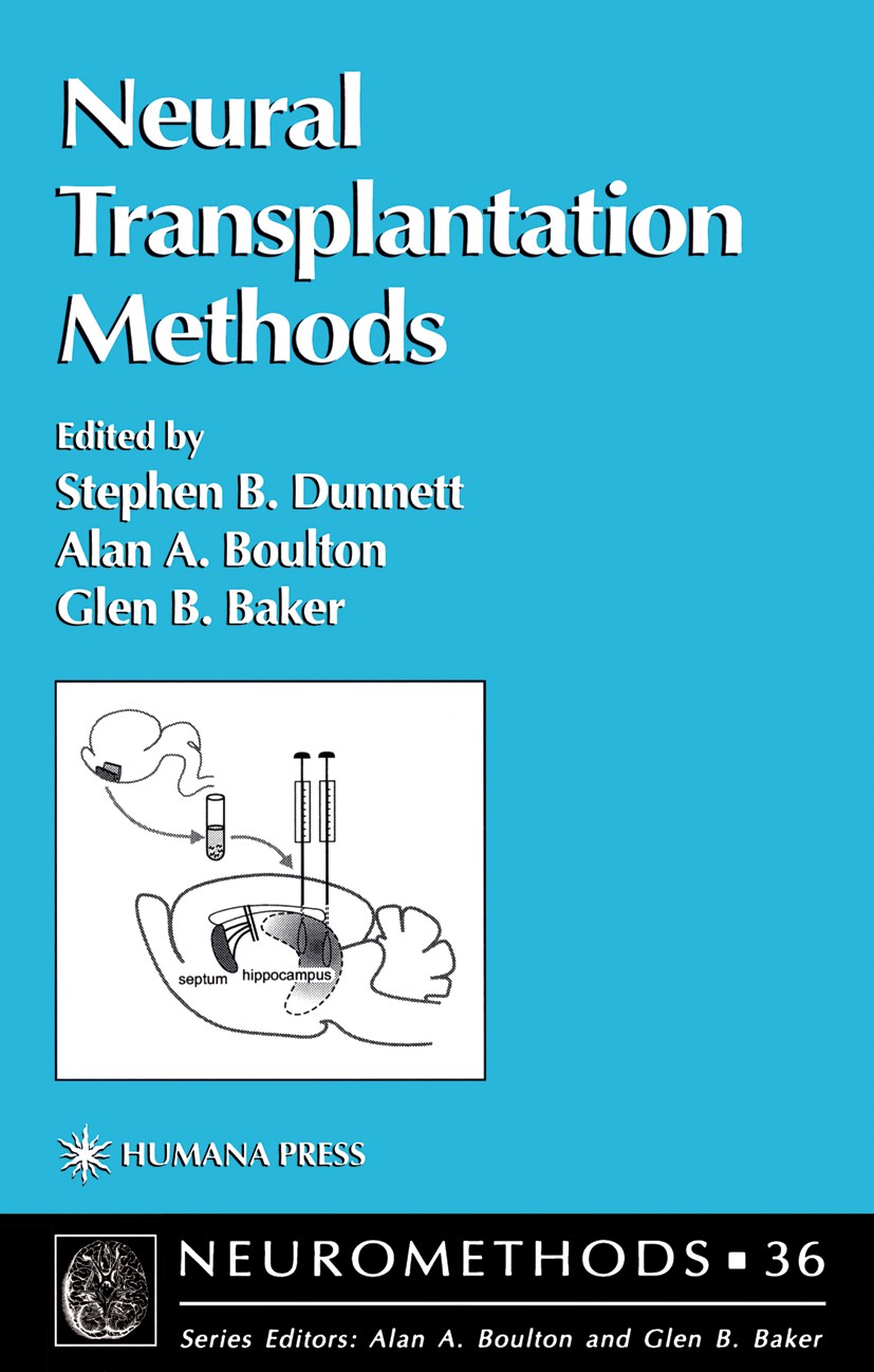 Titlebook: Neural Transplantation Methods; Stephen B. Dunnett,Alan A. Boulton,Glen B. Baker Book 2000 Humana Press 2000 Titlebook: Neural Transplantation Methods; Stephen B. Dunnett,Alan A. Boulton,Glen B. Baker Book 2000 Humana Press 2000