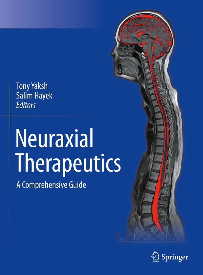 Titlebook: Neuraxial Therapeutics; A Comprehensive Guid Tony Yaksh,Salim Hayek Book 2023 Springer Nature Switzerland AG 2023 Intrathecal Drug Delivery Titlebook: Neuraxial Therapeutics; A Comprehensive Guid Tony Yaksh,Salim Hayek Book 2023 Springer Nature Switzerland AG 2023 Intrathecal Drug Delivery