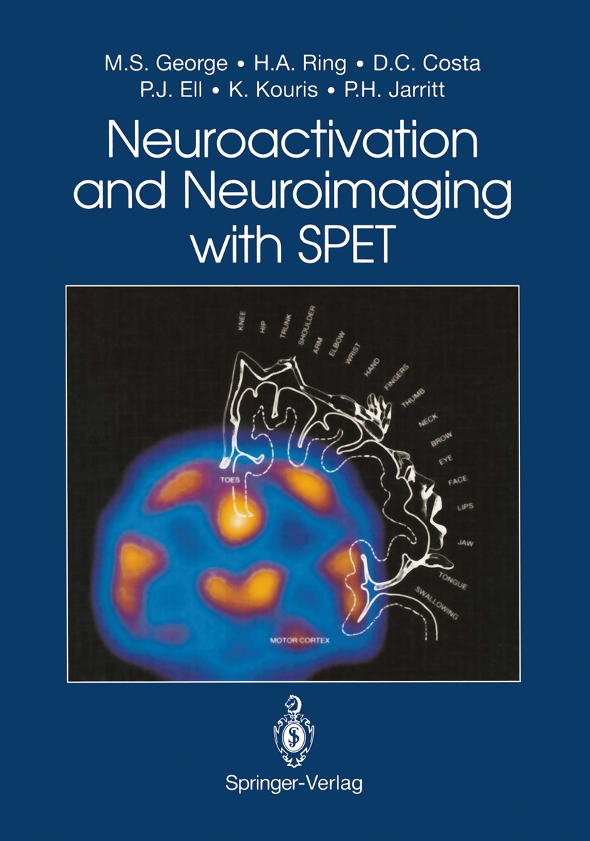 Titlebook: Neuroactivation and Neuroimaging with SPET; Mark S. George,Howard A. Ring,Peter H. Jarritt Book 1991 Springer-Verlag London Limited 1991 S Titlebook: Neuroactivation and Neuroimaging with SPET; Mark S. George,Howard A. Ring,Peter H. Jarritt Book 1991 Springer-Verlag London Limited 1991 S