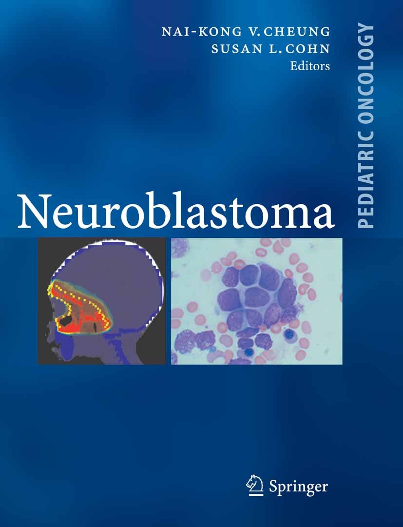 Titlebook: Neuroblastoma; Nai-Kong V. Cheung,Susan L. Cohn Book 2005 Springer-Verlag Berlin Heidelberg 2005 Clinical trials.Genetics.Neuroblastoma.Ri Titlebook: Neuroblastoma; Nai-Kong V. Cheung,Susan L. Cohn Book 2005 Springer-Verlag Berlin Heidelberg 2005 Clinical trials.Genetics.Neuroblastoma.Ri