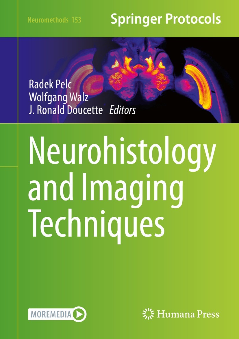 Titlebook: Neurohistology and Imaging Techniques; Radek Pelc,Wolfgang Walz,J. Ronald Doucette Book 2020 Springer Science+Business Media LLC 2020 hist Titlebook: Neurohistology and Imaging Techniques; Radek Pelc,Wolfgang Walz,J. Ronald Doucette Book 2020 Springer Science+Business Media LLC 2020 hist