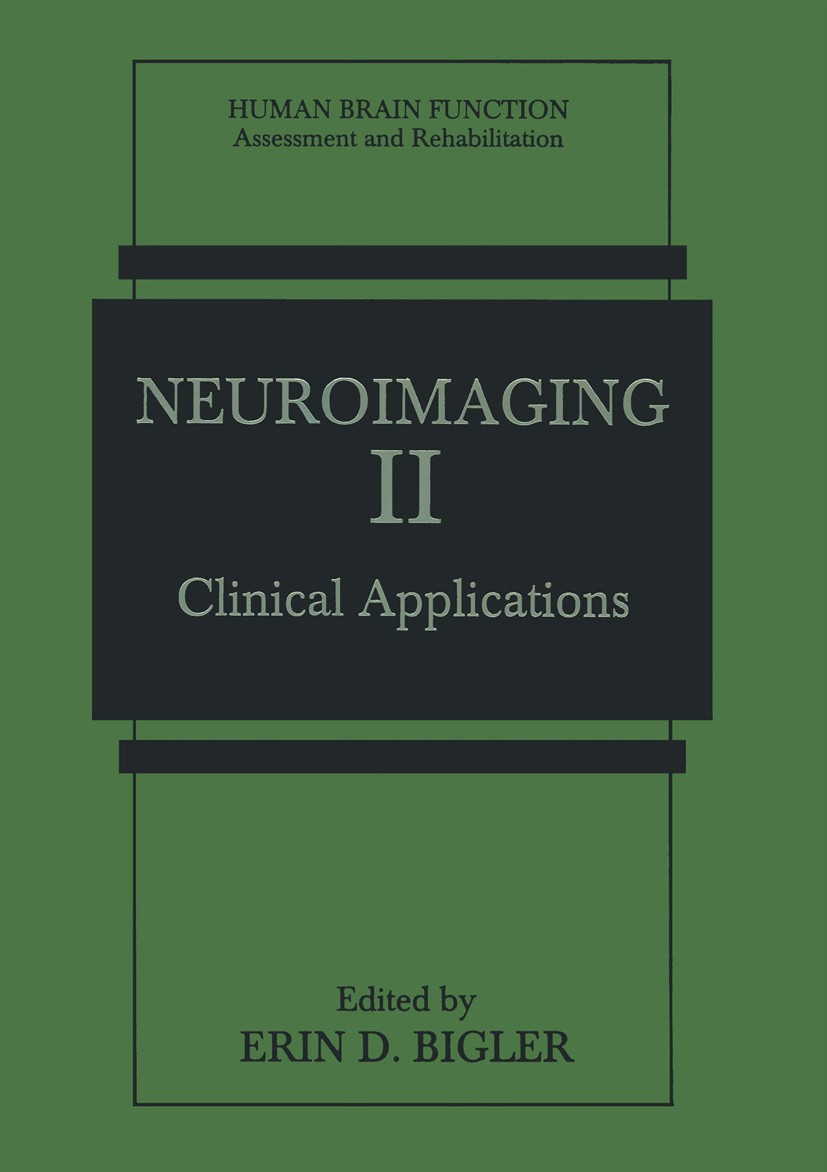 Titlebook: Neuroimaging II; Clinical Application Erin D. Bigler Book 1996 Springer Science+Business Media New York 1996 Syndrom.anatomy.brain.brain im Titlebook: Neuroimaging II; Clinical Application Erin D. Bigler Book 1996 Springer Science+Business Media New York 1996 Syndrom.anatomy.brain.brain im
