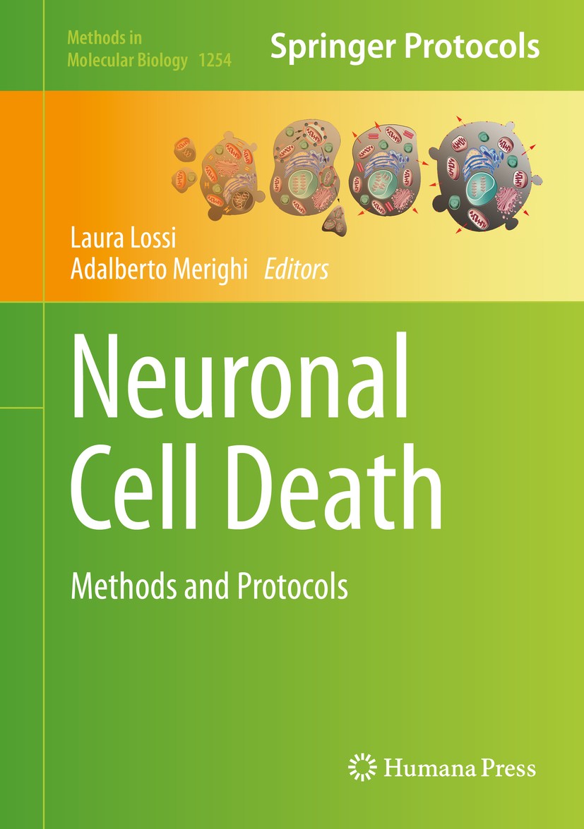 Titlebook: Neuronal Cell Death; Methods and Protocol Laura Lossi,Adalberto Merighi Book 2015 Springer Science+Business Media New York 2015 DNA synthes Titlebook: Neuronal Cell Death; Methods and Protocol Laura Lossi,Adalberto Merighi Book 2015 Springer Science+Business Media New York 2015 DNA synthes
