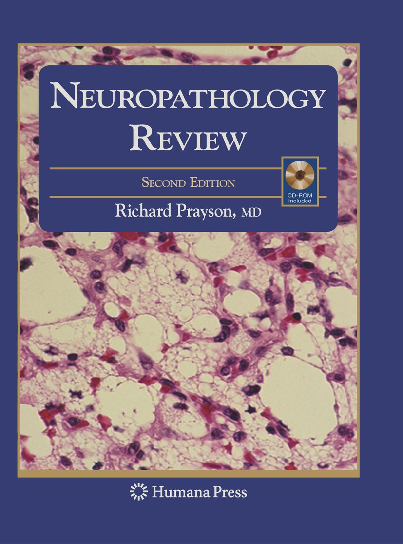 Titlebook: Neuropathology Review; Richard Prayson Book 20082nd edition Humana Press 2008 histology.muscle.neurology.neuropathology.neuroscience.neuro Titlebook: Neuropathology Review; Richard Prayson Book 20082nd edition Humana Press 2008 histology.muscle.neurology.neuropathology.neuroscience.neuro
