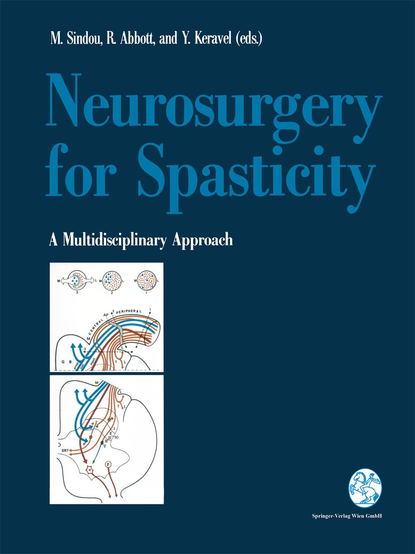 Titlebook: Neurosurgery for Spasticity; A Multidisciplinary Marc P. Sindou,I. Richmond Abbott,Yves Keravel Book 1991 Springer-Verlag Wien 1991 brain. Titlebook: Neurosurgery for Spasticity; A Multidisciplinary Marc P. Sindou,I. Richmond Abbott,Yves Keravel Book 1991 Springer-Verlag Wien 1991 brain.