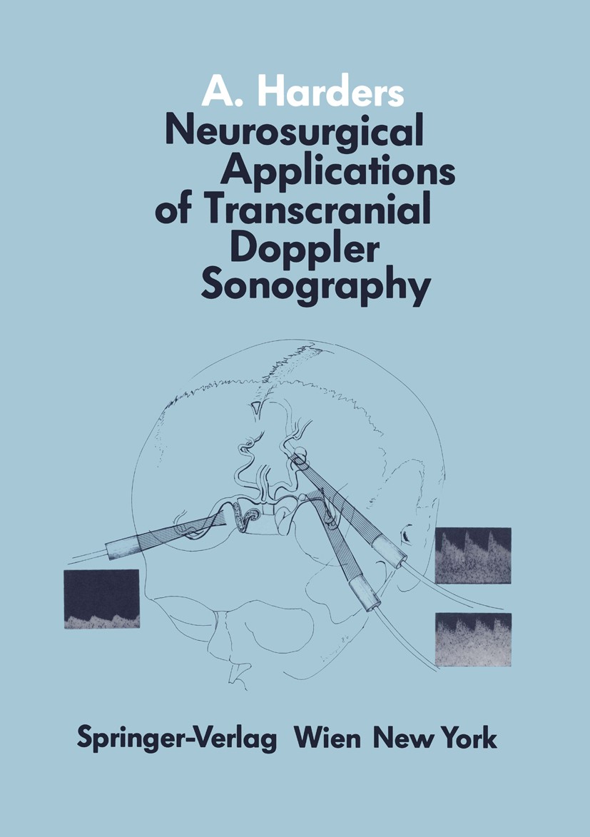 Titlebook: Neurosurgical Applications of Transcranial Doppler Sonography; Albrecht G. Harders Book 1986 Springer-Verlag/Wien 1986 Bypass.aneurysm.ang Titlebook: Neurosurgical Applications of Transcranial Doppler Sonography; Albrecht G. Harders Book 1986 Springer-Verlag/Wien 1986 Bypass.aneurysm.ang