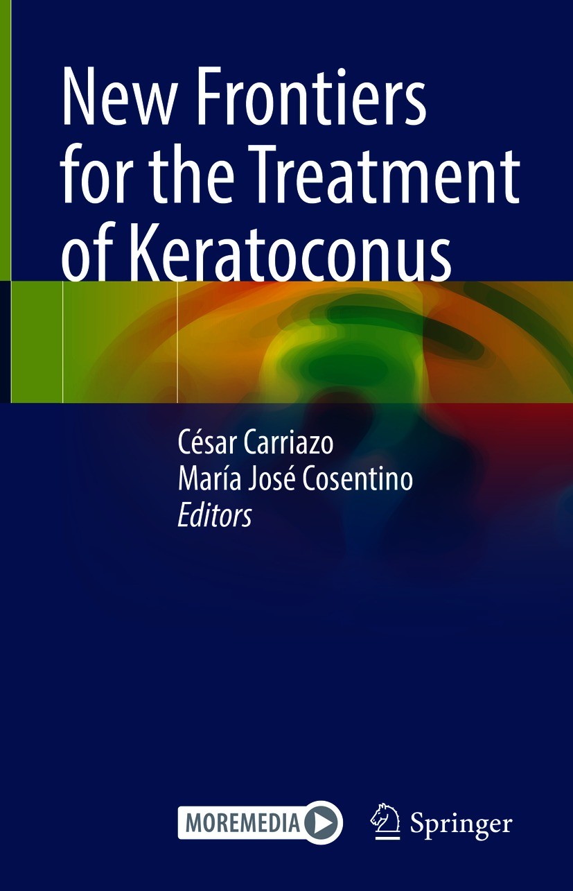 Titlebook: New Frontiers for the Treatment of Keratoconus; César Carriazo,María José Cosentino Book 2021 Springer Nature Switzerland AG 2021 Keratoco Titlebook: New Frontiers for the Treatment of Keratoconus; César Carriazo,María José Cosentino Book 2021 Springer Nature Switzerland AG 2021 Keratoco