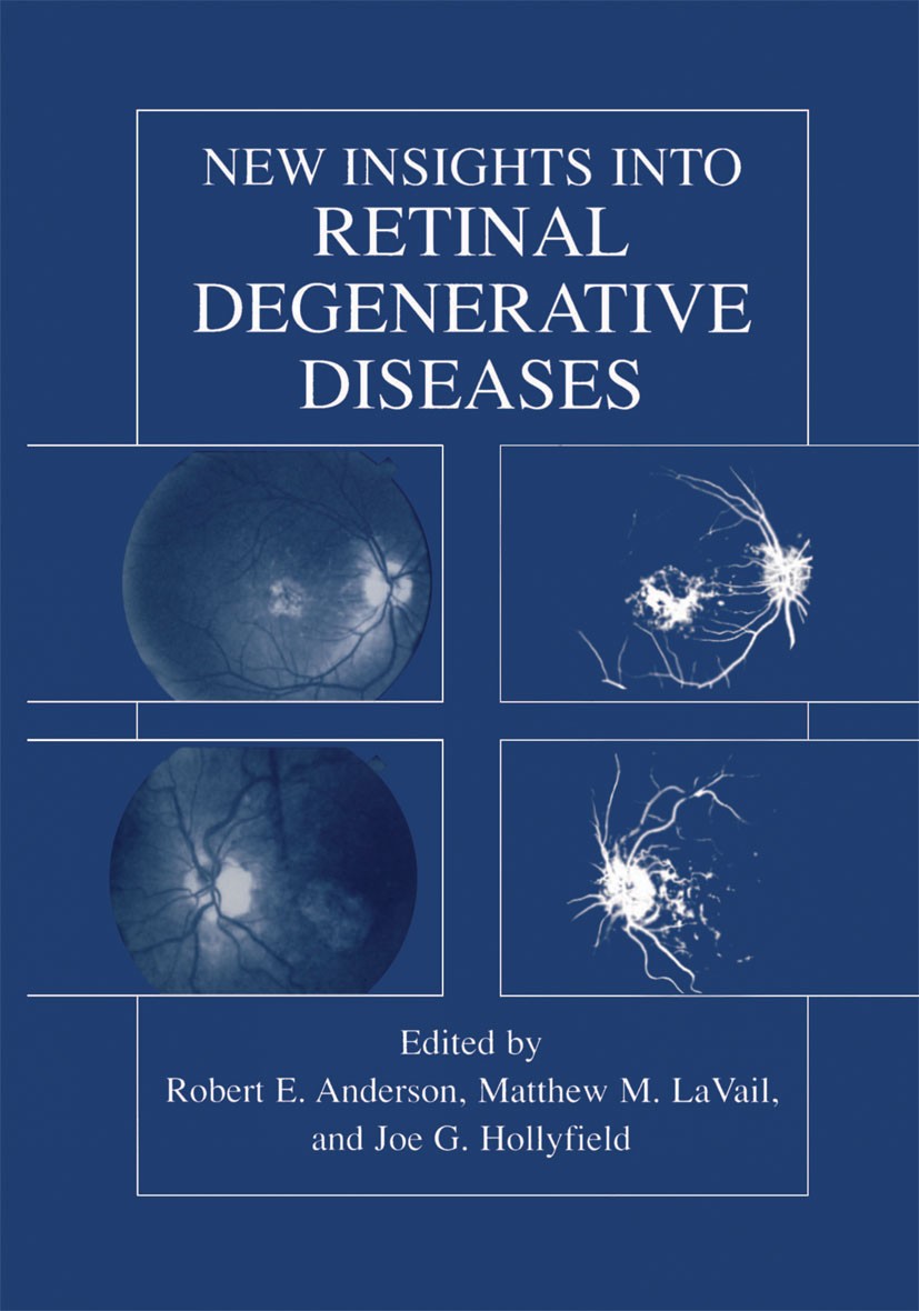 Titlebook: New Insights Into Retinal Degenerative Diseases; Robert E. Anderson,Matthew M. LaVail,Joe G. Hollyf Book 2001 Kluwer Academic / Plenum Pub Titlebook: New Insights Into Retinal Degenerative Diseases; Robert E. Anderson,Matthew M. LaVail,Joe G. Hollyf Book 2001 Kluwer Academic / Plenum Pub