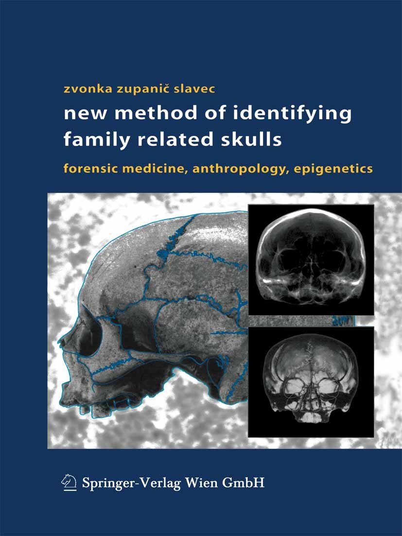 Titlebook: New Method of Identifying Family Related Skulls; Forensic Medicine, A Zvonka Zupanič Slavec Book 2004 Springer-Verlag Wien 2004 Counts of C Titlebook: New Method of Identifying Family Related Skulls; Forensic Medicine, A Zvonka Zupanič Slavec Book 2004 Springer-Verlag Wien 2004 Counts of C