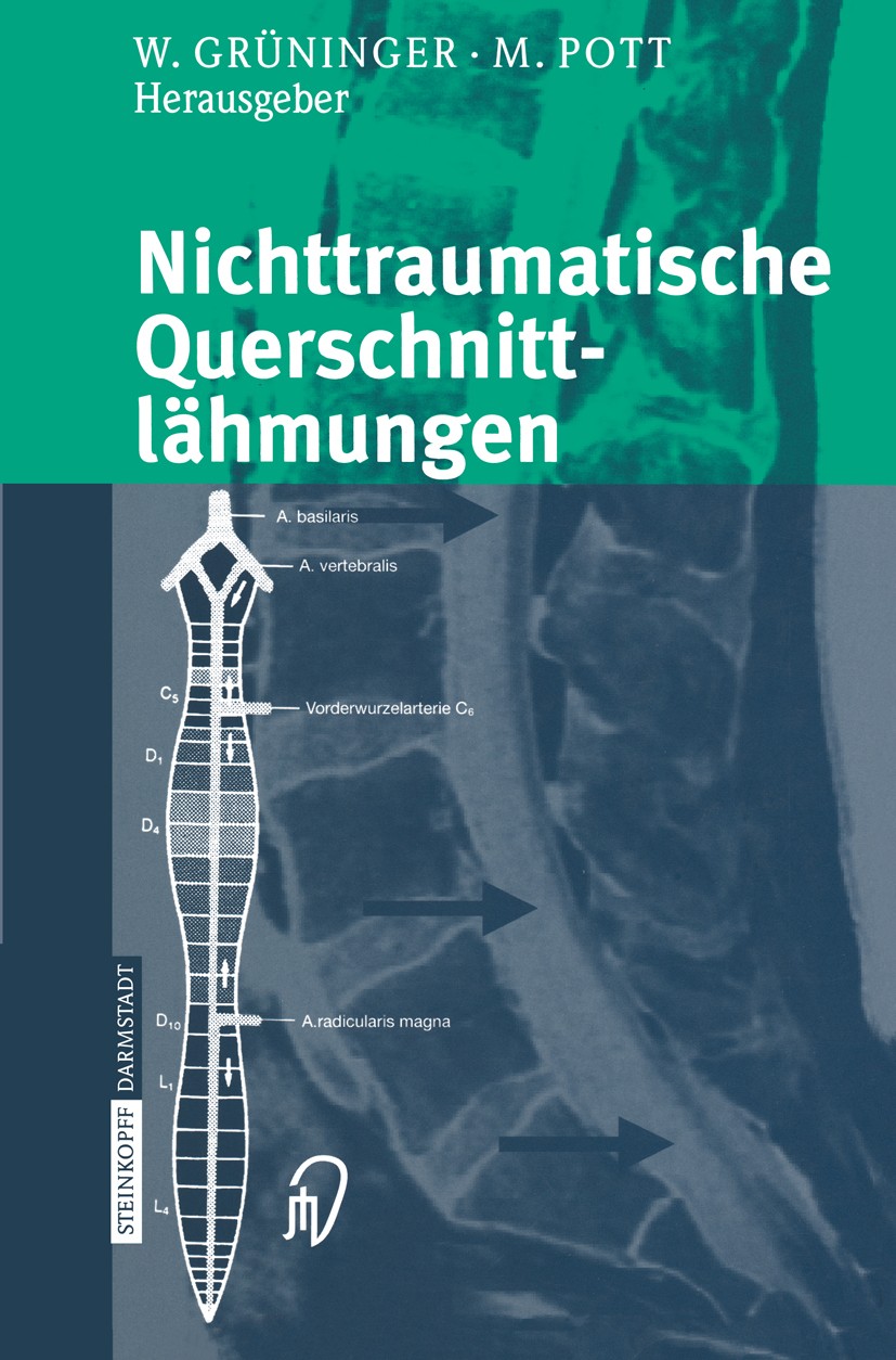 Titlebook: Nichttraumatische Querschnittlähmungen; Werner Grüninger,Michael Pott Conference proceedings 2003 Steinkopff Verlag Darmstadt 2003 Quersch Titlebook: Nichttraumatische Querschnittlähmungen; Werner Grüninger,Michael Pott Conference proceedings 2003 Steinkopff Verlag Darmstadt 2003 Quersch