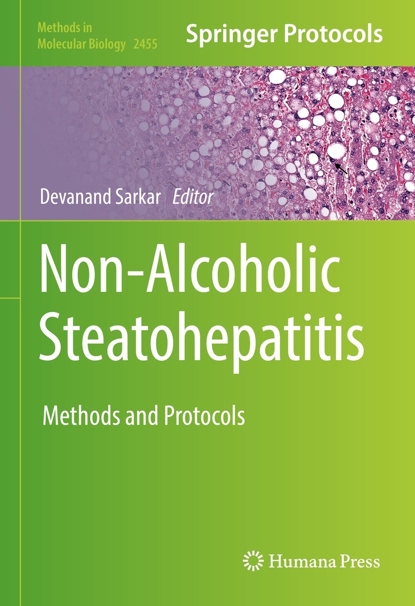 Titlebook: Non-Alcoholic Steatohepatitis; Methods and Protocol Devanand Sarkar Book 2022 The Editor(s) (if applicable) and The Author(s), under exclus Titlebook: Non-Alcoholic Steatohepatitis; Methods and Protocol Devanand Sarkar Book 2022 The Editor(s) (if applicable) and The Author(s), under exclus