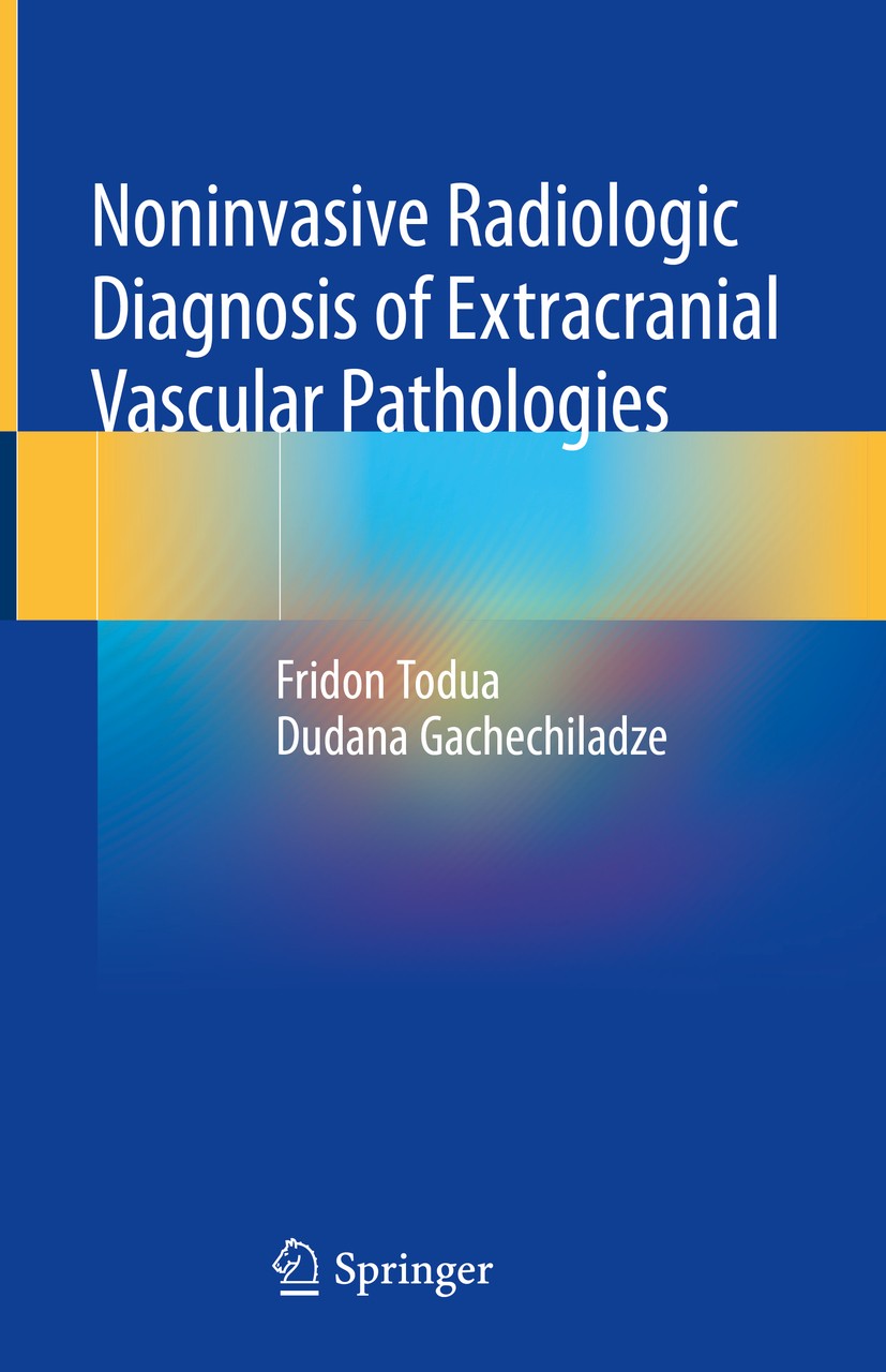 Titlebook: Noninvasive Radiologic Diagnosis of Extracranial Vascular Pathologies; Fridon Todua,Dudana Gachechiladze Book 2018 Springer International Titlebook: Noninvasive Radiologic Diagnosis of Extracranial Vascular Pathologies; Fridon Todua,Dudana Gachechiladze Book 2018 Springer International