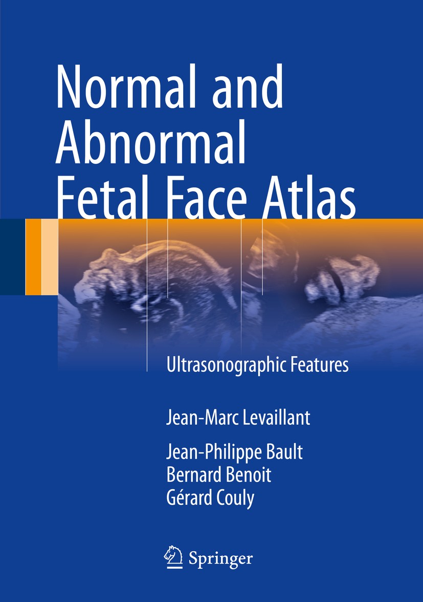 Titlebook: Normal and Abnormal Fetal Face Atlas; Ultrasonographic Fea Jean-Marc Levaillant,Jean-Philippe Bault,Gérard Co Book 2017 Springer Internatio Titlebook: Normal and Abnormal Fetal Face Atlas; Ultrasonographic Fea Jean-Marc Levaillant,Jean-Philippe Bault,Gérard Co Book 2017 Springer Internatio