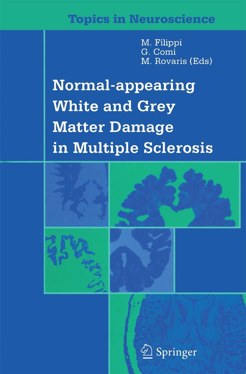 Titlebook: Normal-appearing White and Grey Matter Damage in Multiple Sclerosis; Giancarlo Comi,Massimo Filippi,Marco Rovaris Book 2004 Springer-Verla Titlebook: Normal-appearing White and Grey Matter Damage in Multiple Sclerosis; Giancarlo Comi,Massimo Filippi,Marco Rovaris Book 2004 Springer-Verla