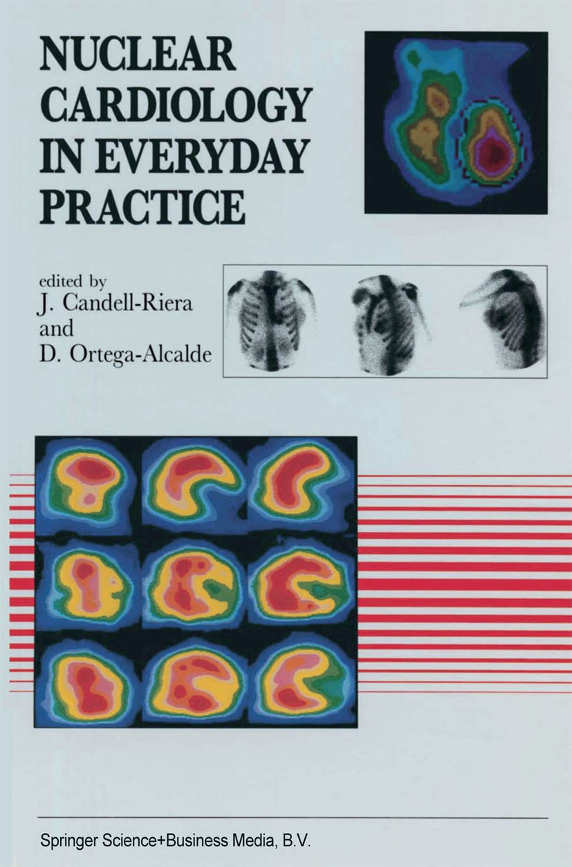 Titlebook: Nuclear Cardiology in Everyday Practice; J. Candell-Riera,D. Ortega-Alcalde Book 1994 Springer Science+Business Media Dordrecht 1994 cardi Titlebook: Nuclear Cardiology in Everyday Practice; J. Candell-Riera,D. Ortega-Alcalde Book 1994 Springer Science+Business Media Dordrecht 1994 cardi