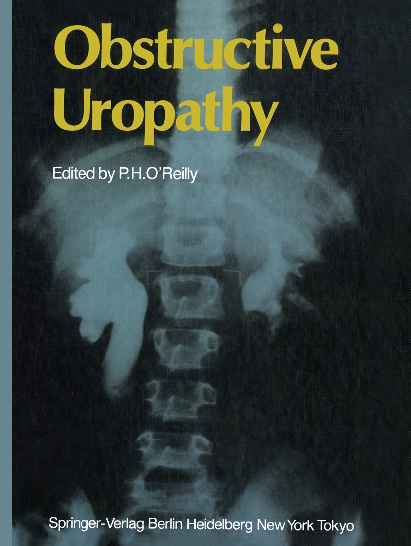 Titlebook: Obstructive Uropathy; P. H. O’Reilly (Consultant Urological Surgeon) Book 1986 Springer-Verlag Berlin Heidelberg 1986 carcinoma.classifica Titlebook: Obstructive Uropathy; P. H. O’Reilly (Consultant Urological Surgeon) Book 1986 Springer-Verlag Berlin Heidelberg 1986 carcinoma.classifica