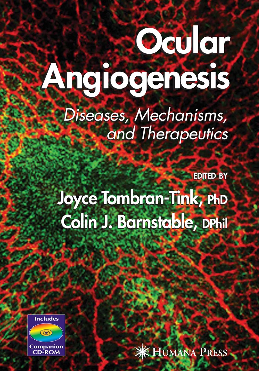 Titlebook: Ocular Angiogenesis; Diseases, Mechanisms Joyce Tombrain-Tink,Colin J. Barnstable Book 2006 Humana Press 2006 eye.glaucoma.macular degenera Titlebook: Ocular Angiogenesis; Diseases, Mechanisms Joyce Tombrain-Tink,Colin J. Barnstable Book 2006 Humana Press 2006 eye.glaucoma.macular degenera