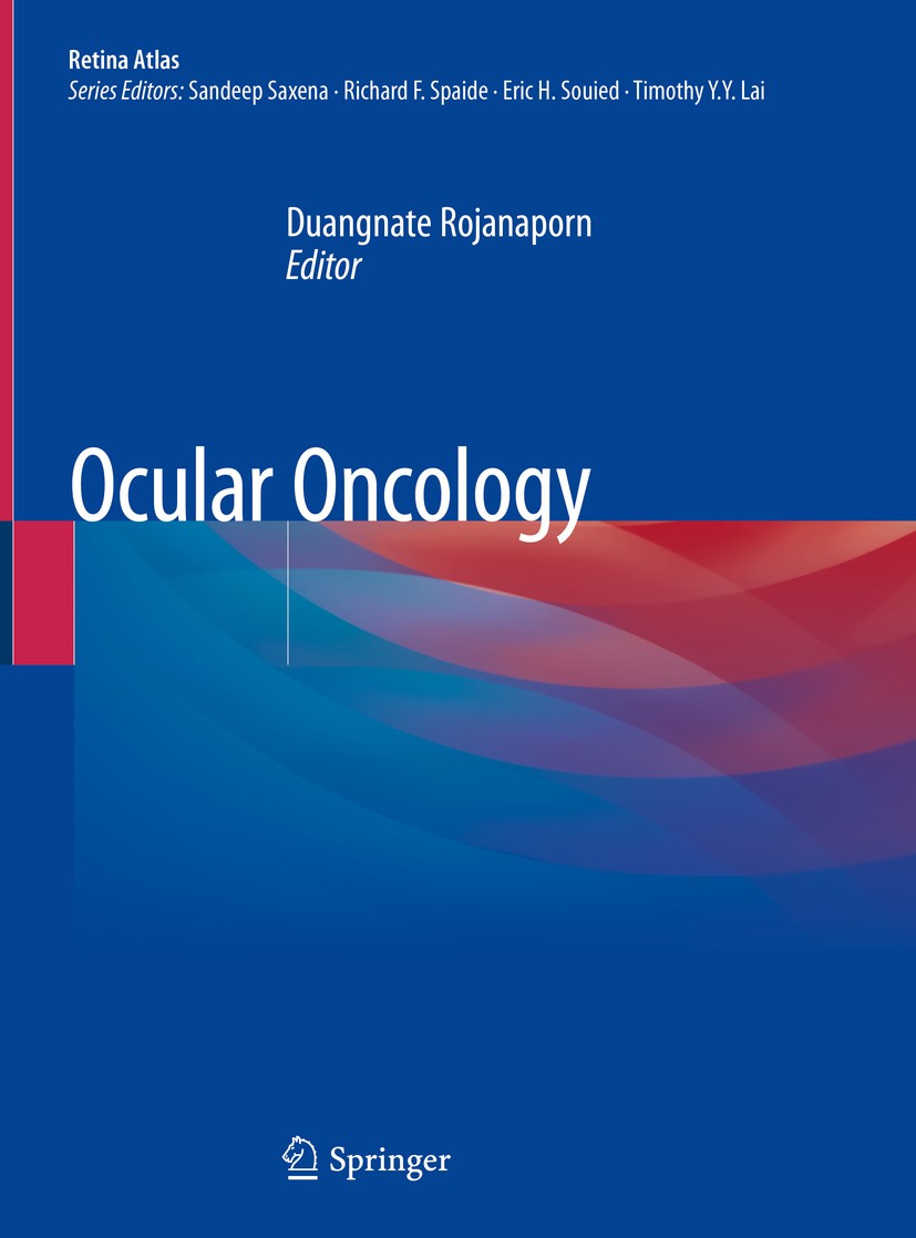 Titlebook: Ocular Oncology; Duangnate Rojanaporn Book 2019 Springer Nature Singapore Pte Ltd. 2019 Choroidal melanoma.Choroidal hemagioma.Retinal vas Titlebook: Ocular Oncology; Duangnate Rojanaporn Book 2019 Springer Nature Singapore Pte Ltd. 2019 Choroidal melanoma.Choroidal hemagioma.Retinal vas