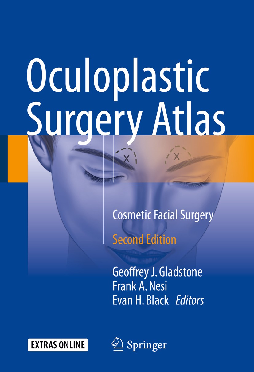 Titlebook: Oculoplastic Surgery Atlas; Cosmetic Facial Surg Geoffrey J. Gladstone,Frank A. Nesi,Evan H. Black Book 2018Latest edition Springer Interna Titlebook: Oculoplastic Surgery Atlas; Cosmetic Facial Surg Geoffrey J. Gladstone,Frank A. Nesi,Evan H. Black Book 2018Latest edition Springer Interna