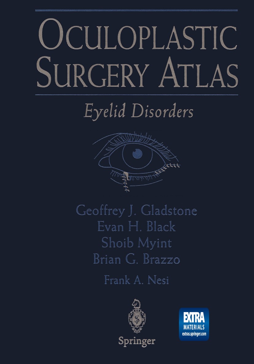 Titlebook: Oculoplastic Surgery Atlas; Eyelid Disorders Geoffrey J. Gladstone,Evan H. Black,Brian G. Brazz Book 20021st edition Springer Science+Busin Titlebook: Oculoplastic Surgery Atlas; Eyelid Disorders Geoffrey J. Gladstone,Evan H. Black,Brian G. Brazz Book 20021st edition Springer Science+Busin