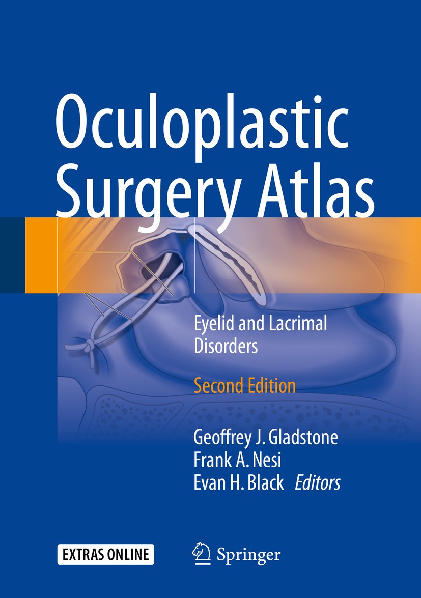 Titlebook: Oculoplastic Surgery Atlas; Eyelid and Lacrimal Geoffrey J. Gladstone,Frank A. Nesi,Evan H. Black Book 2018Latest edition Springer Interna Titlebook: Oculoplastic Surgery Atlas; Eyelid and Lacrimal Geoffrey J. Gladstone,Frank A. Nesi,Evan H. Black Book 2018Latest edition Springer Interna
