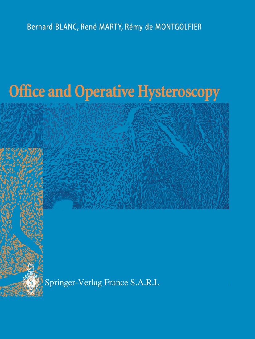 Titlebook: Office and Operative Hysteroscopy; Bernard Blanc,René Marty,Rémy Montgolfier Book 2002 Springer-Verlag France 2002 Endometrium.Uterus.comp Titlebook: Office and Operative Hysteroscopy; Bernard Blanc,René Marty,Rémy Montgolfier Book 2002 Springer-Verlag France 2002 Endometrium.Uterus.comp