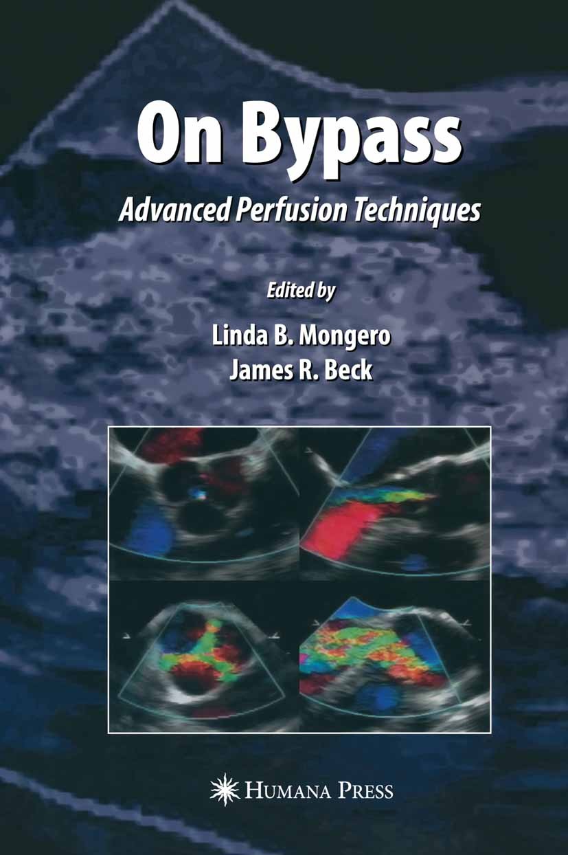 Titlebook: On Bypass; Advanced Perfusion T Linda B. Mongero,James R. Beck Book 2008 Humana Press 2008 Bypass.Surgery.cardiac surgery.circulation.echoc Titlebook: On Bypass; Advanced Perfusion T Linda B. Mongero,James R. Beck Book 2008 Humana Press 2008 Bypass.Surgery.cardiac surgery.circulation.echoc