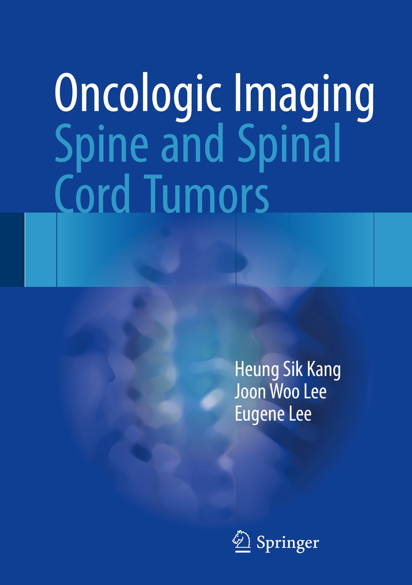 Titlebook: Oncologic Imaging: Spine and Spinal Cord Tumors; Heung Sik Kang,Joon Woo Lee,Eugene Lee Book 2017 Springer Science+Business Media Singapor Titlebook: Oncologic Imaging: Spine and Spinal Cord Tumors; Heung Sik Kang,Joon Woo Lee,Eugene Lee Book 2017 Springer Science+Business Media Singapor