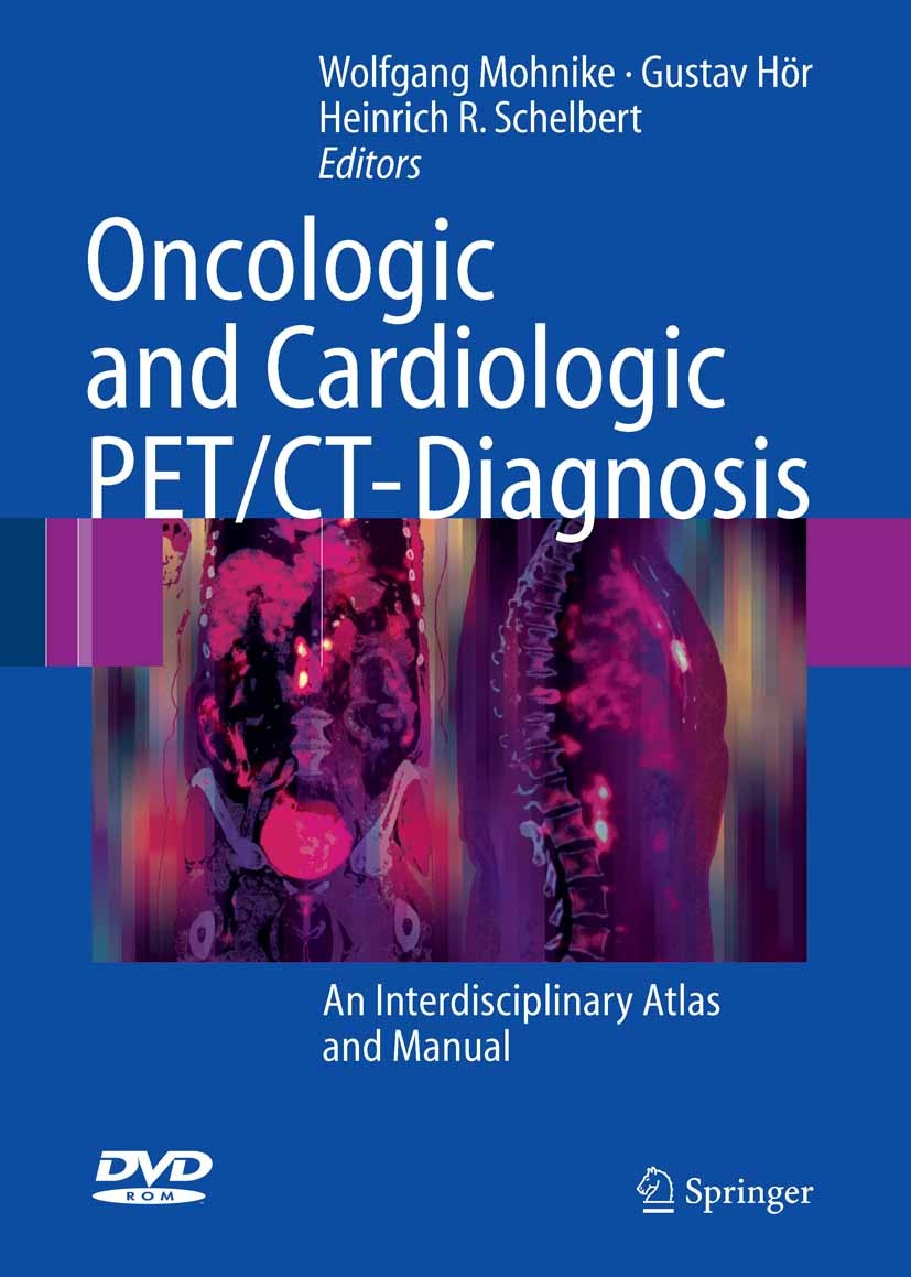 Titlebook: Oncologic and Cardiologic PET/CT-Diagnosis; An Interdisciplinary Wolfgang Mohnike (Professor),Gustav Hör (Professor Book 2008 Springer-Verl Titlebook: Oncologic and Cardiologic PET/CT-Diagnosis; An Interdisciplinary Wolfgang Mohnike (Professor),Gustav Hör (Professor Book 2008 Springer-Verl