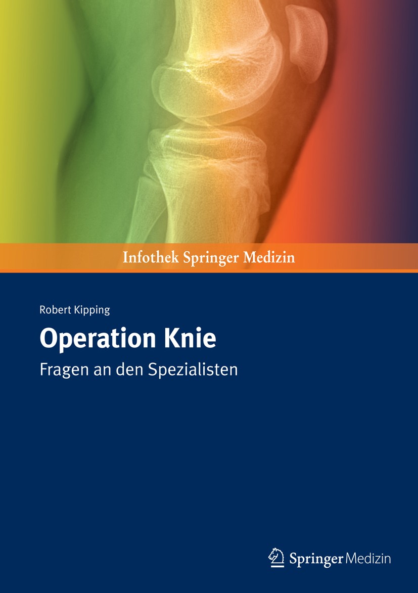 Titlebook: Operation Knie; Fragen an den Spezia Robert Kipping Book 2019 Springer Medizin Verlag GmbH, ein Teil von Springer Nature 2019 Knieerkrankun Titlebook: Operation Knie; Fragen an den Spezia Robert Kipping Book 2019 Springer Medizin Verlag GmbH, ein Teil von Springer Nature 2019 Knieerkrankun
