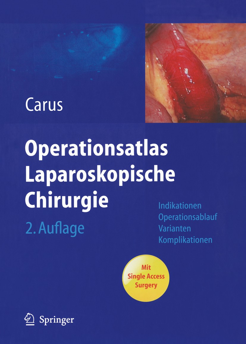 Titlebook: Operationsatlas Laparoskopische Chirurgie; Indikationen - Opera Thomas Carus Book 20102nd edition Springer-Verlag Berlin Heidelberg 2010 Ba Titlebook: Operationsatlas Laparoskopische Chirurgie; Indikationen - Opera Thomas Carus Book 20102nd edition Springer-Verlag Berlin Heidelberg 2010 Ba