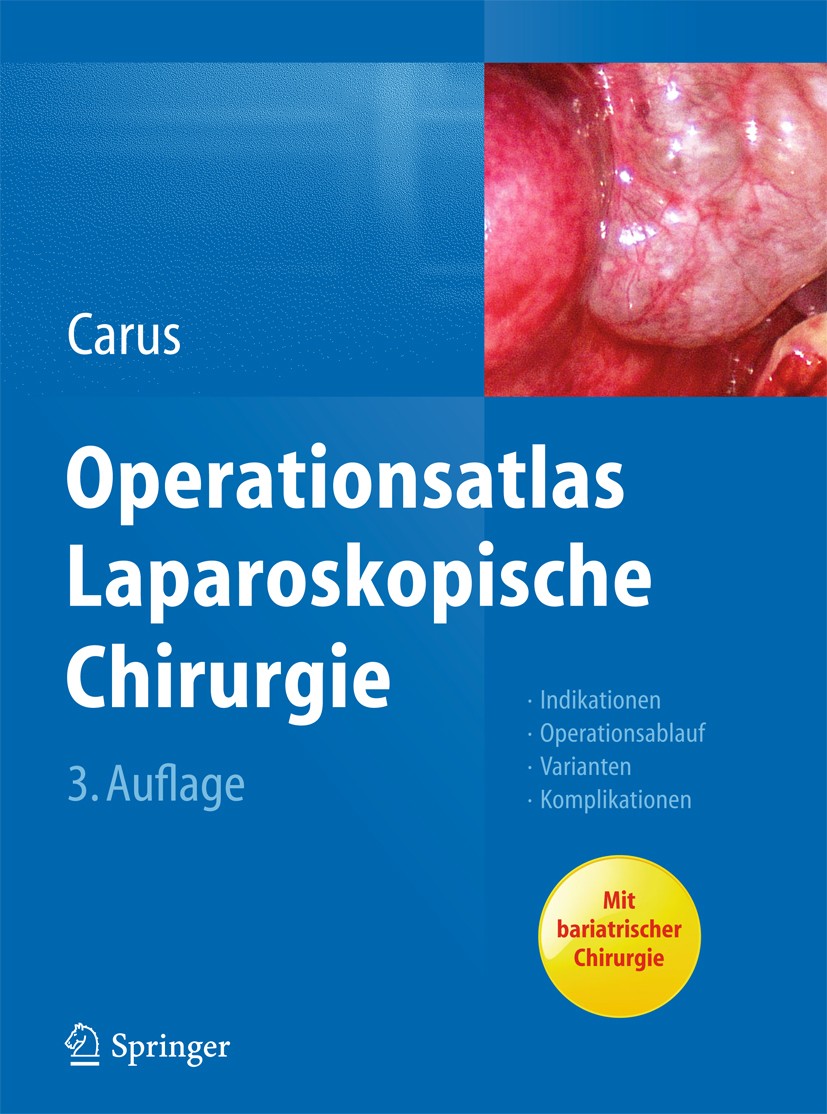 Titlebook: Operationsatlas Laparoskopische Chirurgie; Indikationen - Opera Thomas Carus Book 20143rd edition Springer-Verlag Berlin Heidelberg 2014 Ab Titlebook: Operationsatlas Laparoskopische Chirurgie; Indikationen - Opera Thomas Carus Book 20143rd edition Springer-Verlag Berlin Heidelberg 2014 Ab