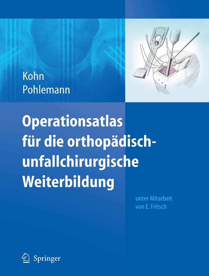 Titlebook: Operationsatlas für die orthopädisch-unfallchirurgische Weiterbildung; Dieter Kohn,Tim Pohlemann,Ekkehard Fritsch Book 20101st edition Spr Titlebook: Operationsatlas für die orthopädisch-unfallchirurgische Weiterbildung; Dieter Kohn,Tim Pohlemann,Ekkehard Fritsch Book 20101st edition Spr