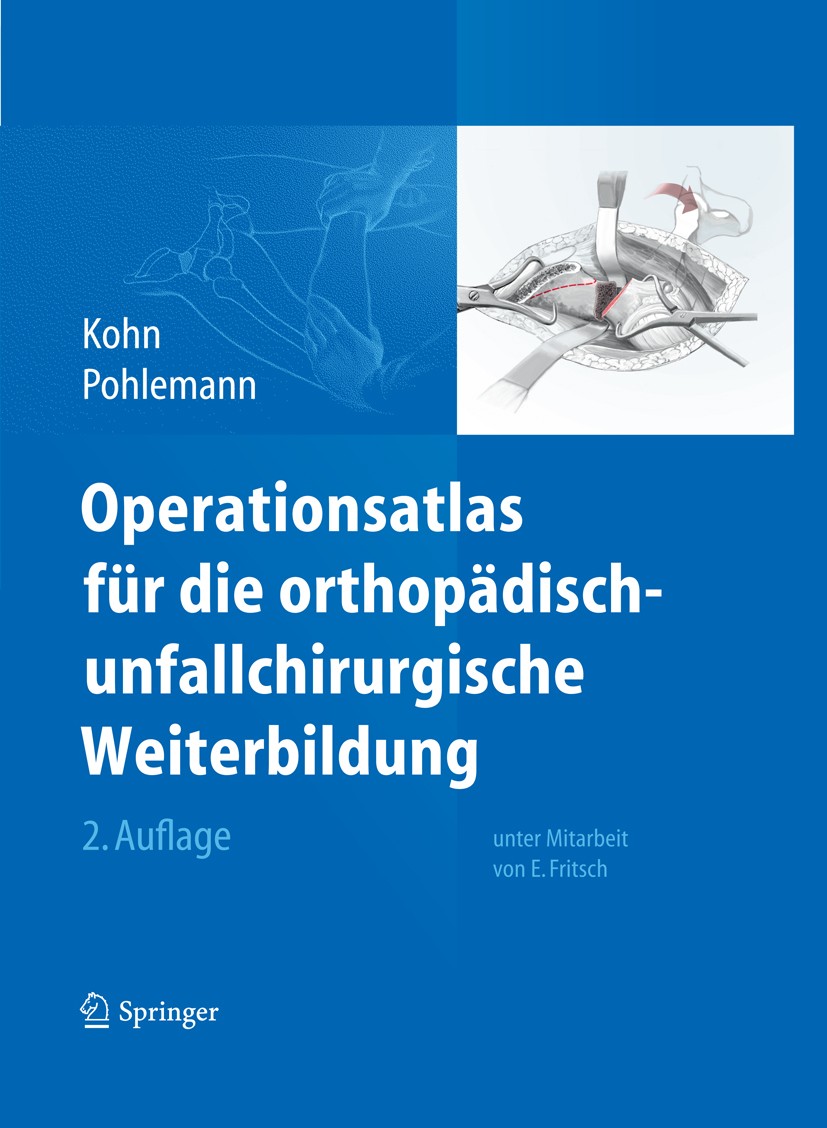 Titlebook: Operationsatlas für die orthopädisch-unfallchirurgische Weiterbildung; Dieter Kohn,Tim Pohlemann Book 2013Latest edition Springer-Verlag B Titlebook: Operationsatlas für die orthopädisch-unfallchirurgische Weiterbildung; Dieter Kohn,Tim Pohlemann Book 2013Latest edition Springer-Verlag B