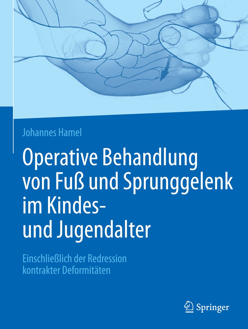 Titlebook: Operative Behandlung von Fuß und Sprunggelenk im Kindes- und Jugendalter; Einschließlich der R Johannes Hamel Book 2019 Springer-Verlag Gmb Titlebook: Operative Behandlung von Fuß und Sprunggelenk im Kindes- und Jugendalter; Einschließlich der R Johannes Hamel Book 2019 Springer-Verlag Gmb