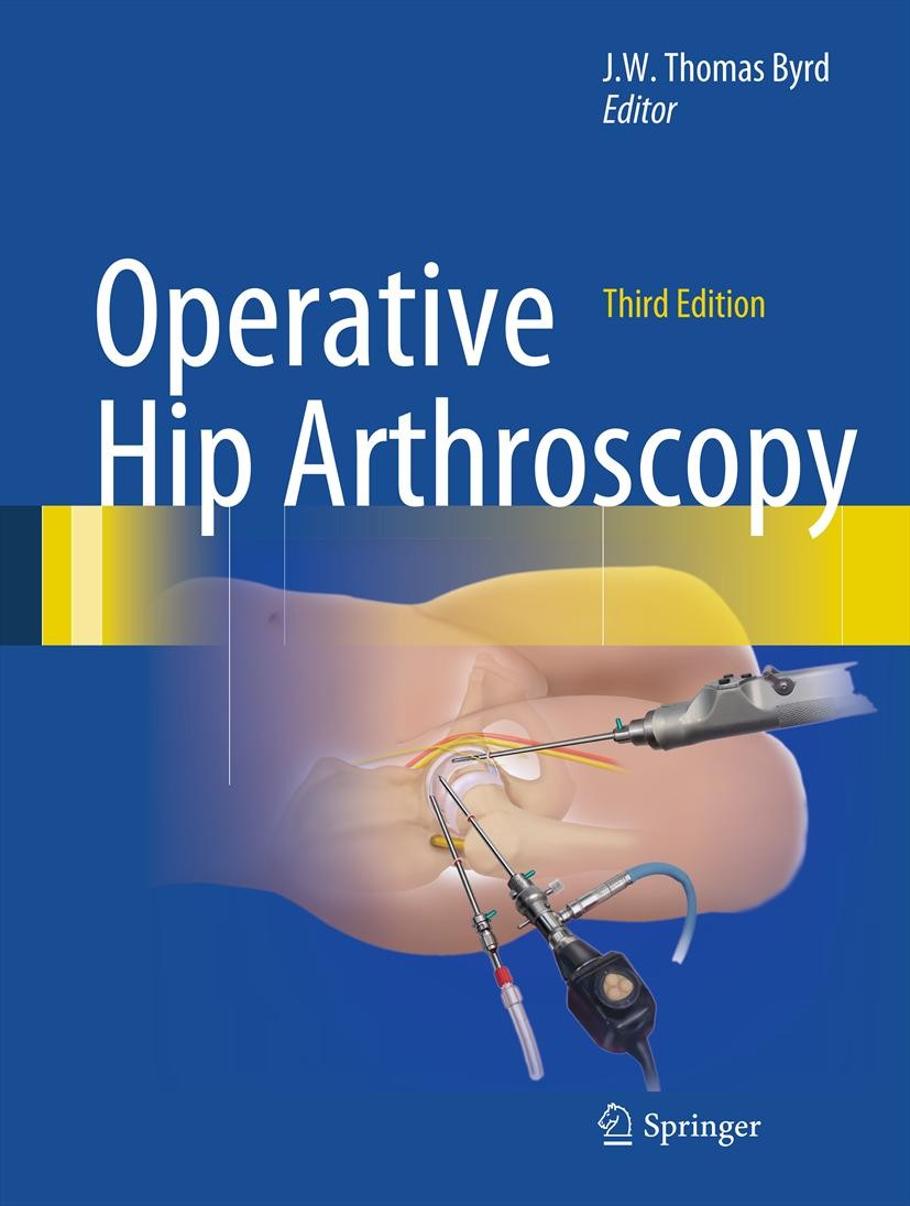 Titlebook: Operative Hip Arthroscopy; J.W. Thomas Byrd Book 2013Latest edition Springer Science+Business Media New York 2013 Titlebook: Operative Hip Arthroscopy; J.W. Thomas Byrd Book 2013Latest edition Springer Science+Business Media New York 2013