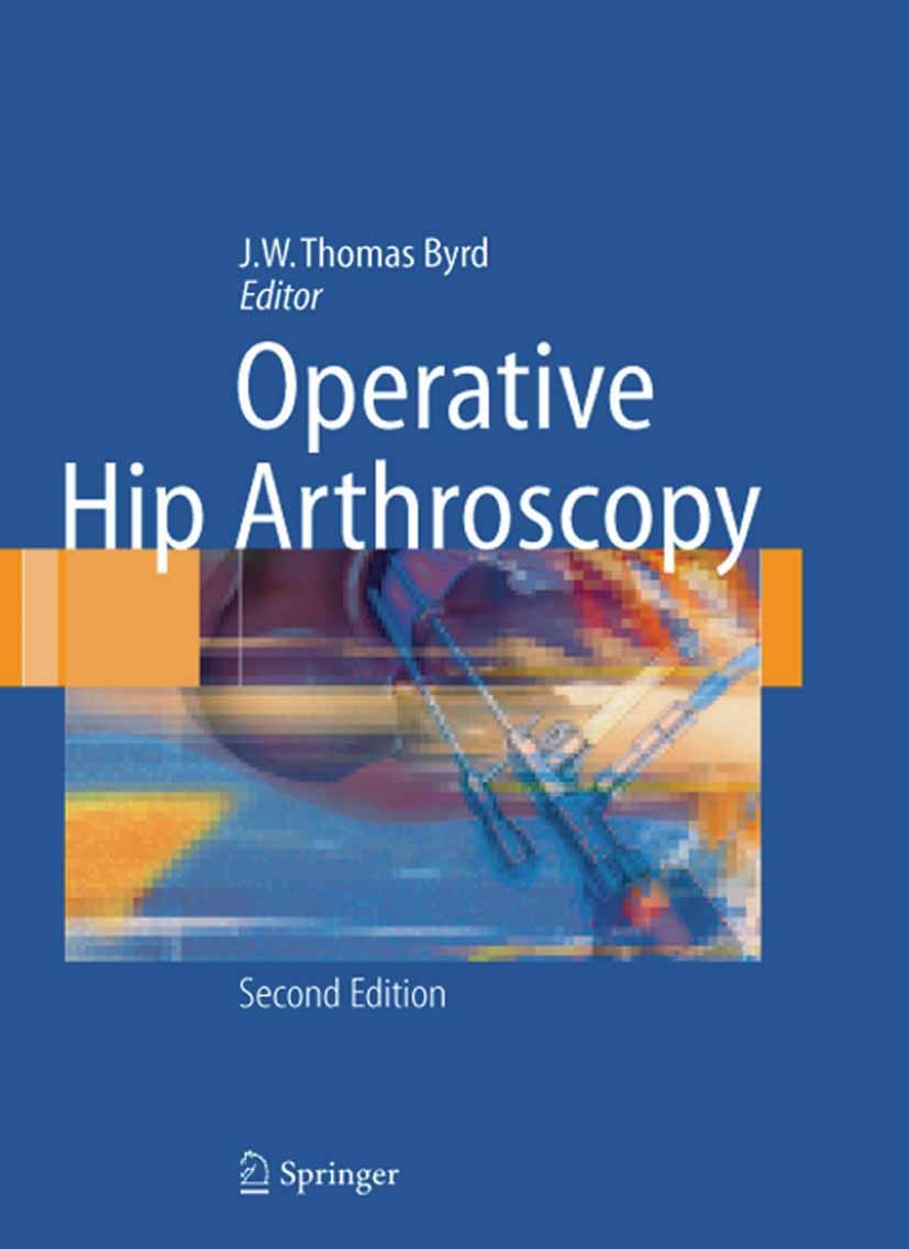 Titlebook: Operative Hip Arthroscopy; J.W. Thomas Byrd (Assistant Clinical Professor) Book 20052nd edition Springer-Verlag New York 2005 Titlebook: Operative Hip Arthroscopy; J.W. Thomas Byrd (Assistant Clinical Professor) Book 20052nd edition Springer-Verlag New York 2005
