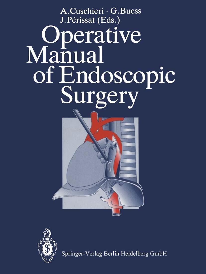 Titlebook: Operative Manual of Endoscopic Surgery; A. Cuschieri,G. Buess,J. Périssat Book 1992 Springer-Verlag Berlin Heidelberg 1992 Atmen.Cholezyst Titlebook: Operative Manual of Endoscopic Surgery; A. Cuschieri,G. Buess,J. Périssat Book 1992 Springer-Verlag Berlin Heidelberg 1992 Atmen.Cholezyst