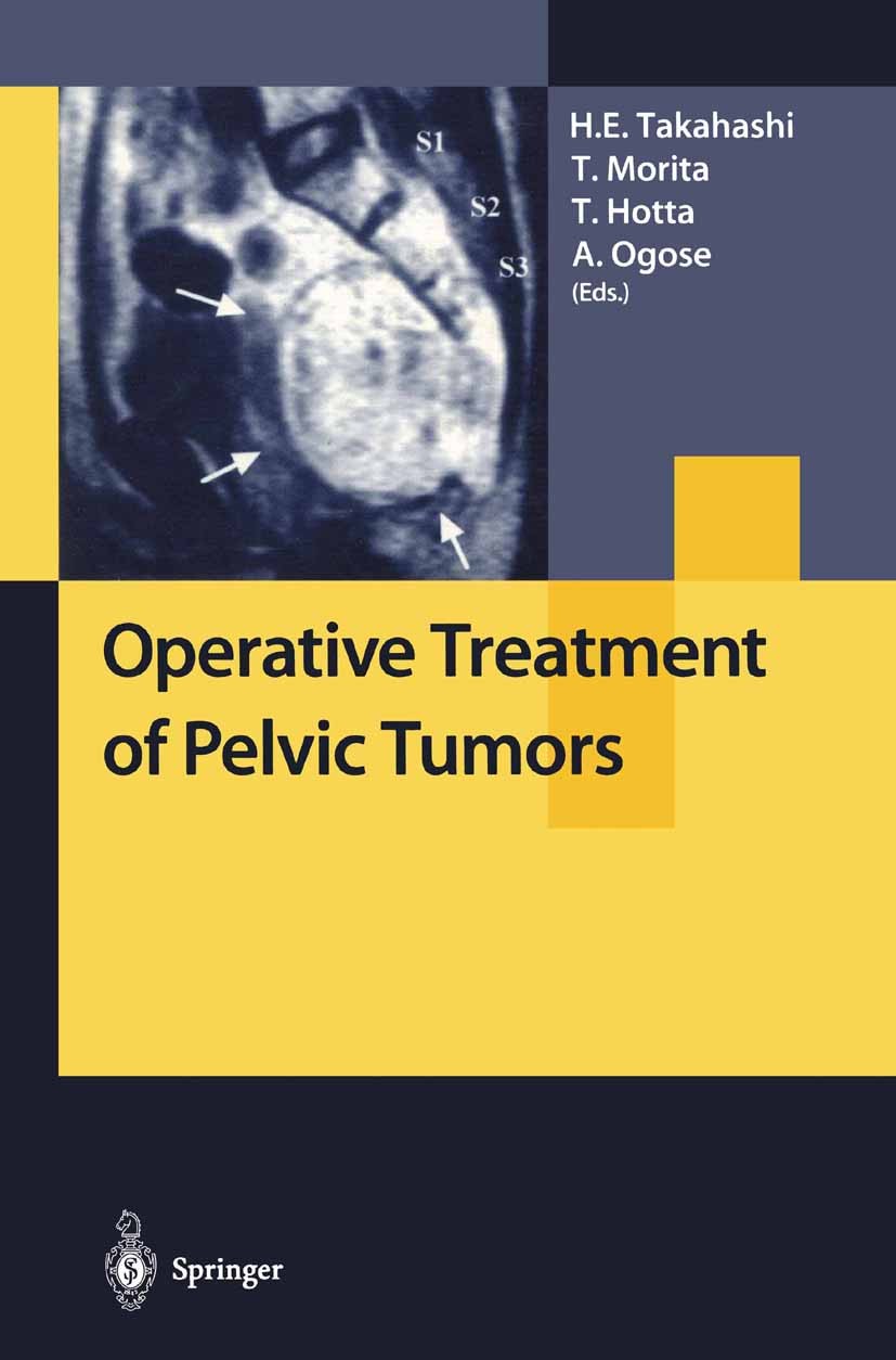 Titlebook: Operative Treatment of Pelvic Tumors; Hideaki E. Takahashi (President),Tetsuro Morita (C Book 2003 Springer-Verlag Tokyo 2003 anatomy.arth Titlebook: Operative Treatment of Pelvic Tumors; Hideaki E. Takahashi (President),Tetsuro Morita (C Book 2003 Springer-Verlag Tokyo 2003 anatomy.arth