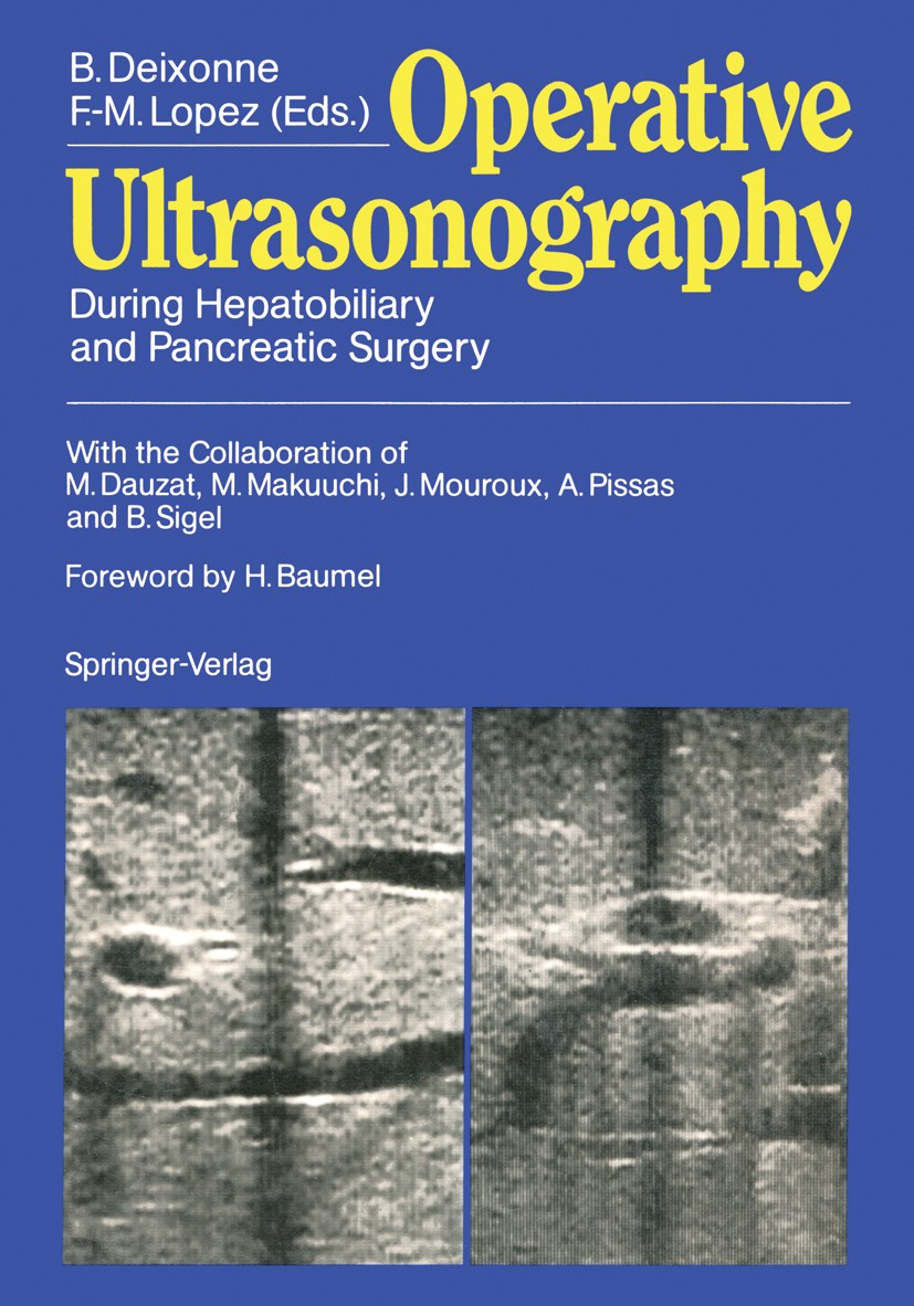 Titlebook: Operative Ultrasonography; During Hepatobiliary Bernard Deixonne,Francois-Michel Lopez (Professor Book 1988 Springer-Verlag Berlin Heidelb Titlebook: Operative Ultrasonography; During Hepatobiliary Bernard Deixonne,Francois-Michel Lopez (Professor Book 1988 Springer-Verlag Berlin Heidelb
