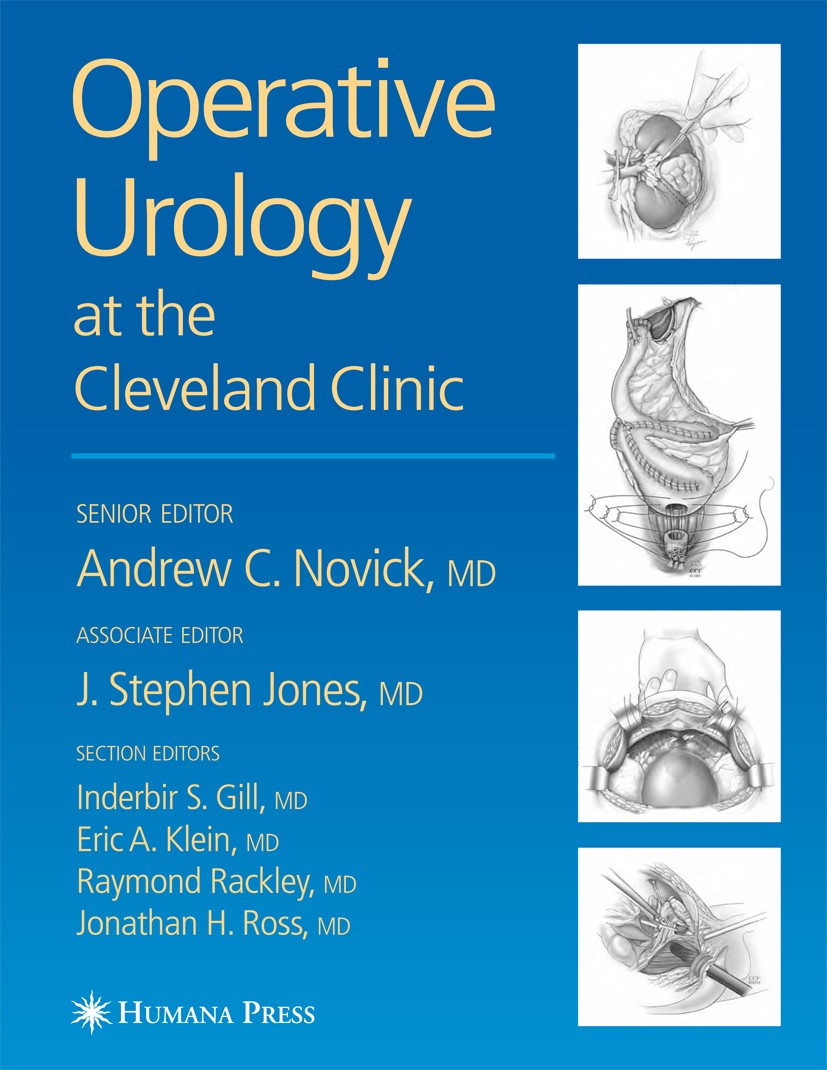 Titlebook: Operative Urology; Andrew C. Novick,J. Stephen Jones,Jonathan H. Ross Book 2006 Humana Press 2006 carcinoma.cystectomy.kidney.prostate can Titlebook: Operative Urology; Andrew C. Novick,J. Stephen Jones,Jonathan H. Ross Book 2006 Humana Press 2006 carcinoma.cystectomy.kidney.prostate can