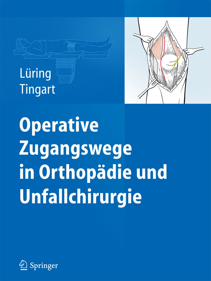 Titlebook: Operative Zugangswege in Orthopädie und Unfallchirurgie; Christian Lüring,Markus Tingart Book 2015 Springer-Verlag Berlin Heidelberg 2015 Titlebook: Operative Zugangswege in Orthopädie und Unfallchirurgie; Christian Lüring,Markus Tingart Book 2015 Springer-Verlag Berlin Heidelberg 2015